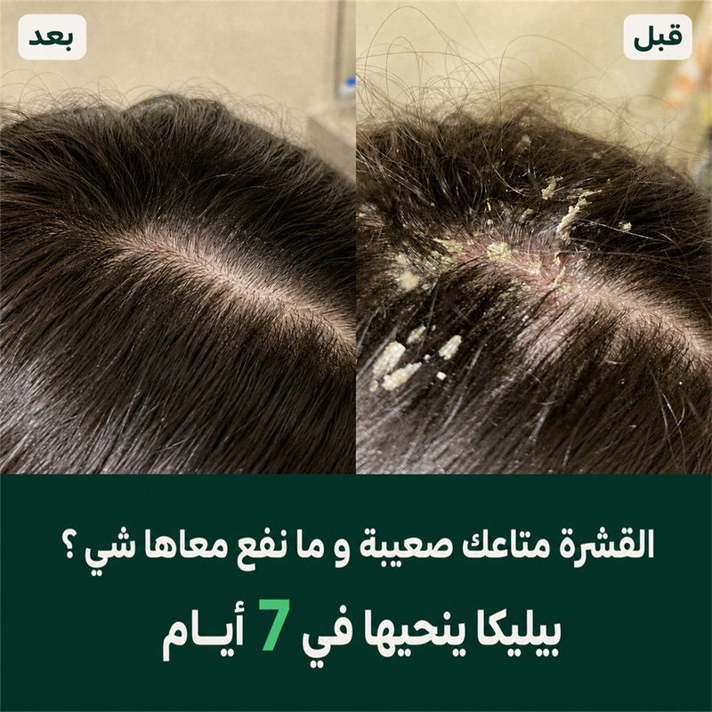 Pillica - Shampooing Antipelliculaire